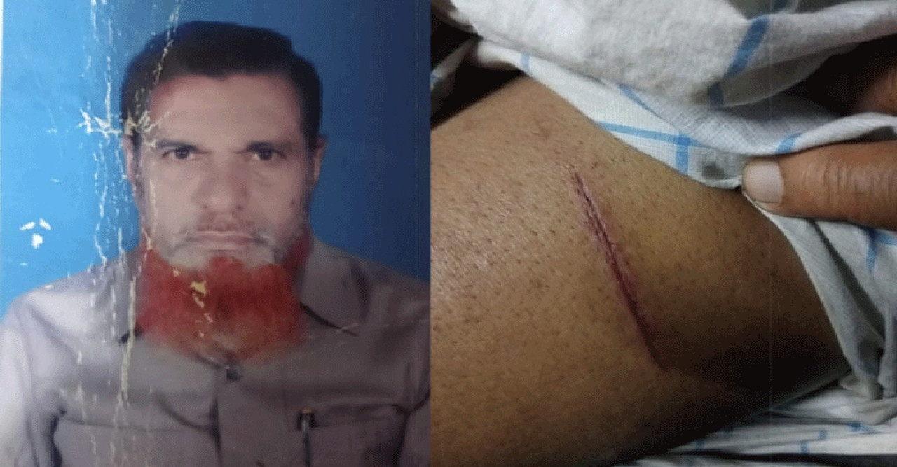 ফরিদপুরে এনসিপি নেতা হাসিবুর রহমান অপুর বাবার ওপর সন্ত্রাসী হামলা